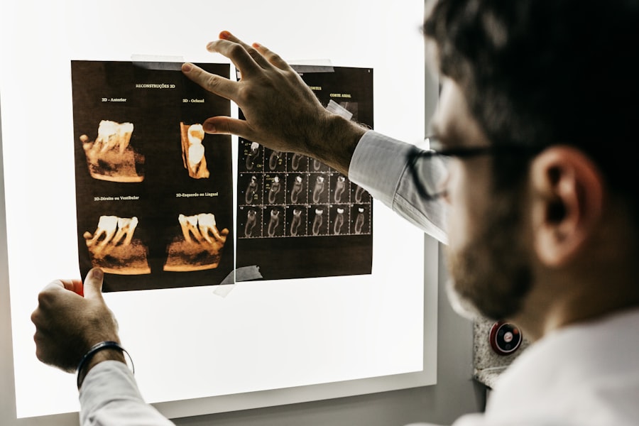 Digital X-ray diagnosis