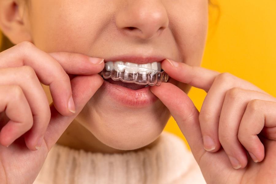 Clear aligner treatment